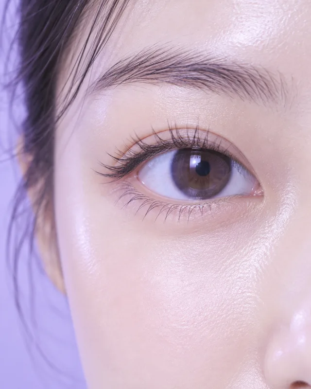 다크서클·눈밑 꺼짐 — 리쥬란아이, 눈밑 필러, 튠아이즈